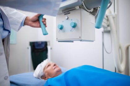 snimanje-pluca-covid19