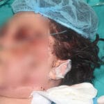 nikolija-vuckovic-povredjena-u-bolnici-blur