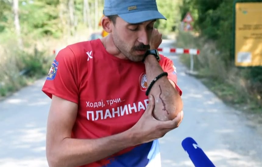 milos-kuvekalovic-napad-kablar