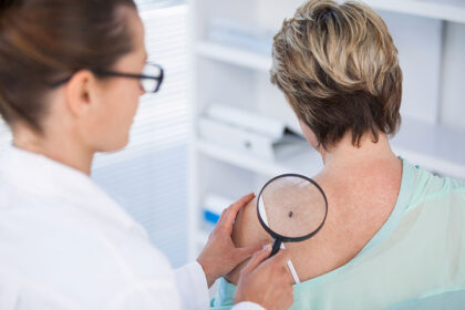 pregled-koze-lekar-melanom